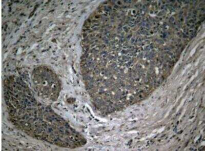 Immunohistochemistry-Paraffin: RelA/NFkB p65 [p Ser536] Antibody [NB100-82088]